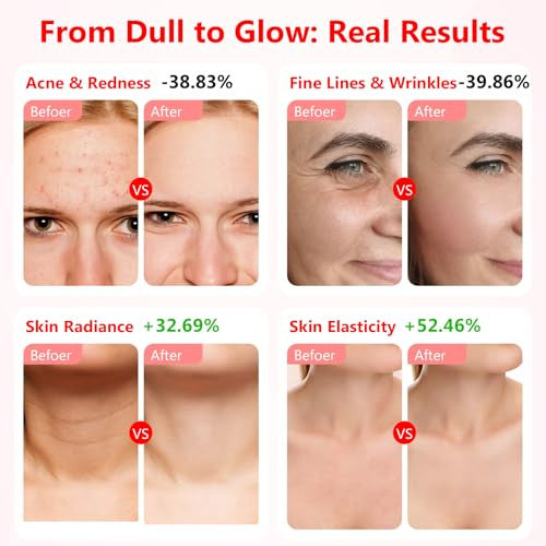 USUIELIGHT LED arcmaszk fényterápia, 7 színű LED maszk arcra és nyakra anti-aging